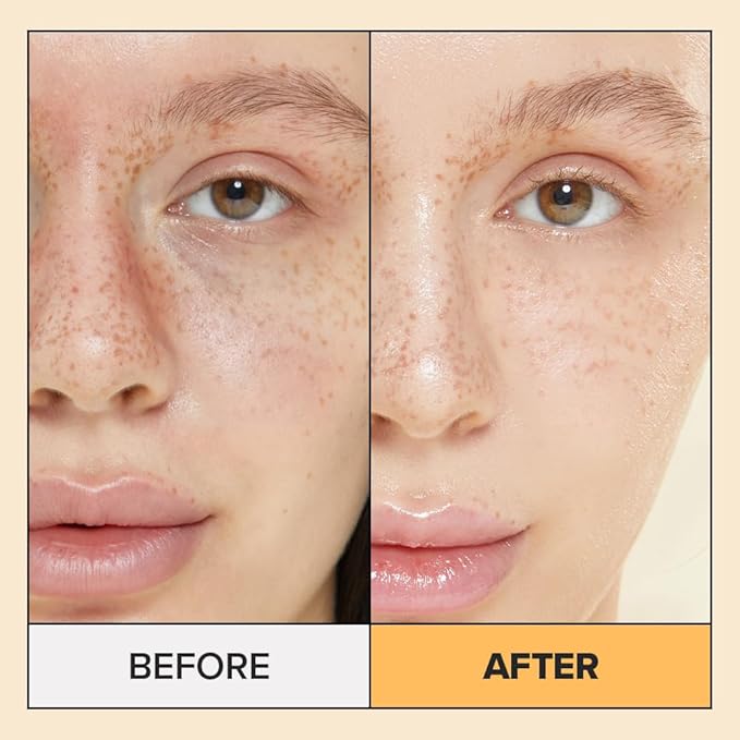 I DEW CARE Calendula Sheet Face Mask - Korean Skincare for Hydrating and Calming Skin | Face Masks with Calendula Extract & Niacinamide, Moisturizing Korean Skin Care, Sheet Masks for Women, 10EA