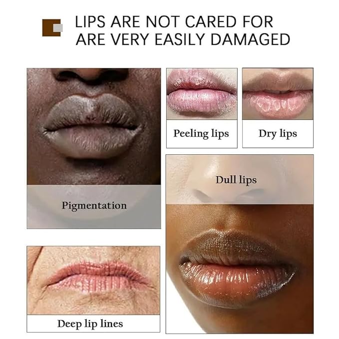 2PCS Handmade Plant lip balm Pink Lips Serum Brighten Dark Lips Bleaching Essence Lip Balm Repair Fine Lines Brighten Moisture Exfoliator Lip Care (Yellow)