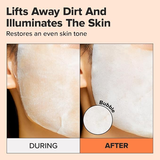 I DEW CARE Bubble Face Sheet Mask - Korean Skincare for Brightening and Detox | Skin Care with Vitamin&Niacinamide, Hydrating face mask skincare, Facial Hydrating Treatment, Sheet Masks for Women, 5EA