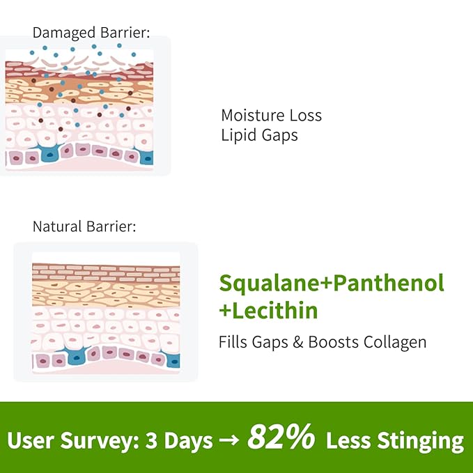 Squalane Matte Daily Face Moisturizer Cream with Hyaluronic Acid - 72H Hydration, Barrier Repair, Calms Redness | Fragrance-Free, Derm-Tested for Women & Men with Ultra Sensitive & Dry Skin