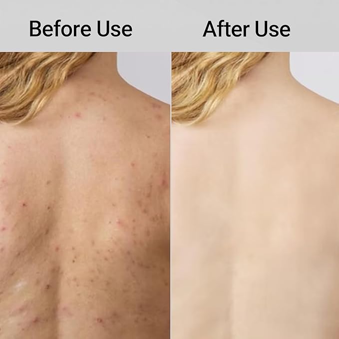 Exfoliating Shower Towel,Premium Scrub Wash Cloth for Body Face,Quick Drying Durable and Gentle for Sensitive Skin,Travel Friendly. (2)