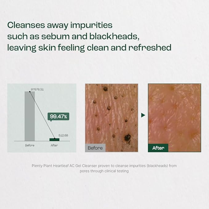 Heartleaf AC Cleanser Gel Type Deep Pore Cleansing, Acne Face Wash, Blackhead Remover for All Skin Types, Korean Skin Care 9.90 fl oz(293ml)