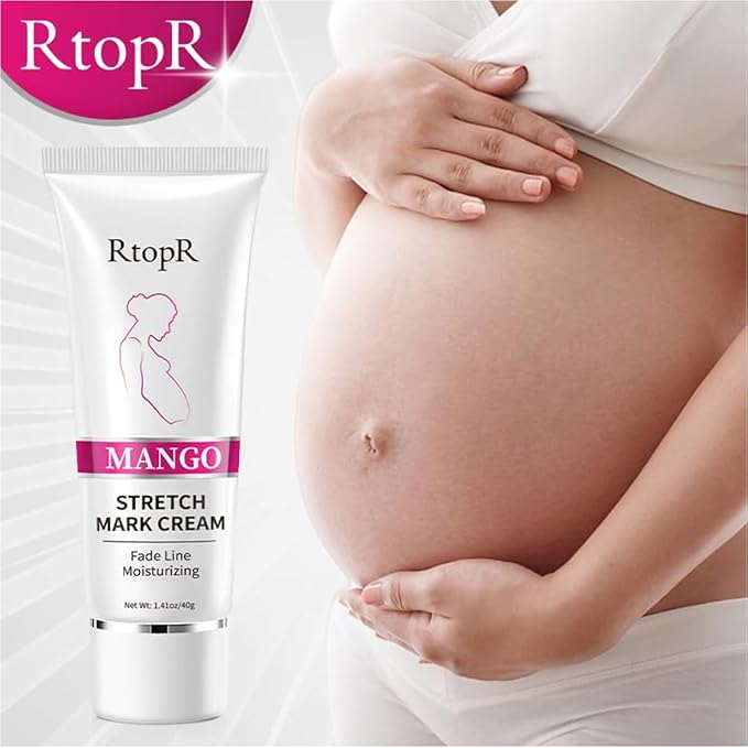 Stretch Mark Removal Cream, Obesity Stretch Mark Moisturizer, Postpartum Repair Stretch Mark Cream, Abdominal Stretch Mark Cream, Remove Marks (2 PCS)