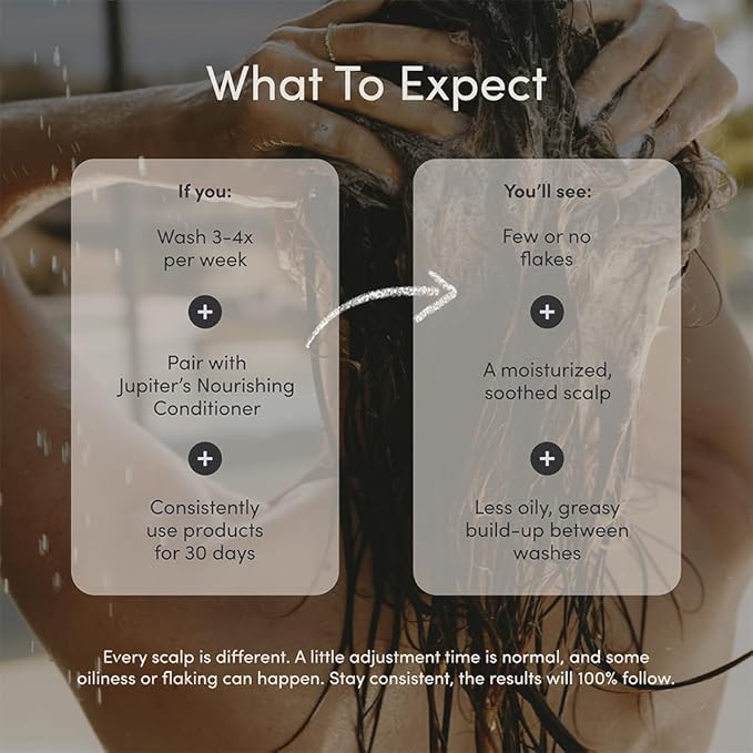 Jupiter Anti-Dandruff Scalp Serum, Leave-On Restoring Serum, for Dry, Itchy, & Oily Scalp, Aloe Vera, & Niacinamide, Color-Safe, Vegan, Cruelty-Free, Paraben, Phthalate, & Sulfate-Free, 3.4 fl oz