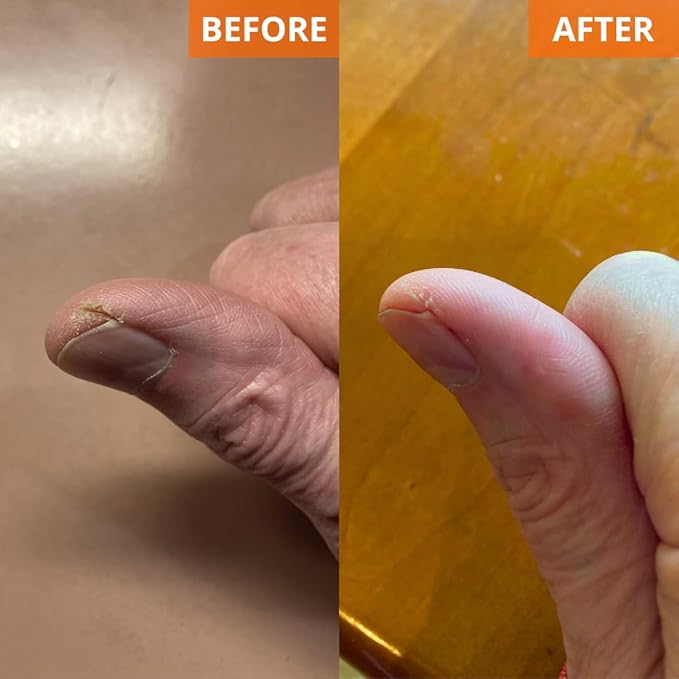 Yu-Be Ultra Hydration Duo (Jar & Tube) – Deeply Moisturizing Cream for Day & Night | Non-Greasy Formula with Camphor & Vitamins | Softens and Nourishes Dry Skin