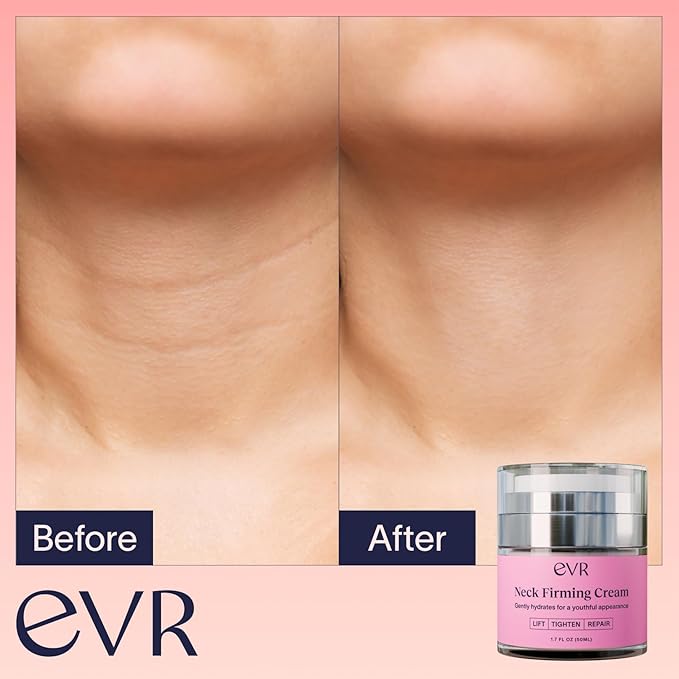 Anti-aging Neck Firming Cream with Collagen & Hyaluronic Acid - Made in USA with Natural & Organic Ingredients Face Neck and Chest Tightening Moisturizer (Classic)
