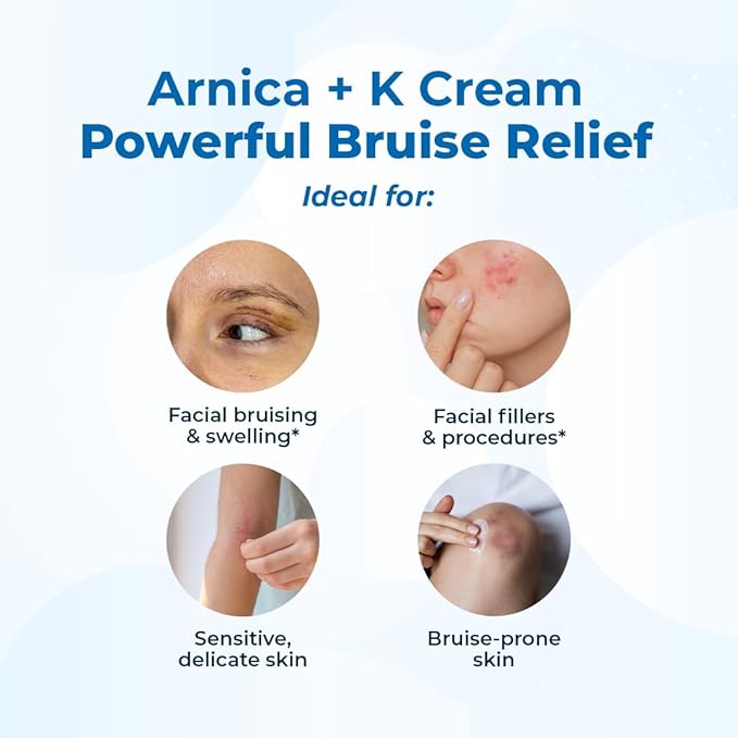 VitaMedica Arnica Cream - Arnica Montana + Vitamin K Oxide Bruise Cream - Sensitive Skin Formula - Undereye - 0.5 ounces