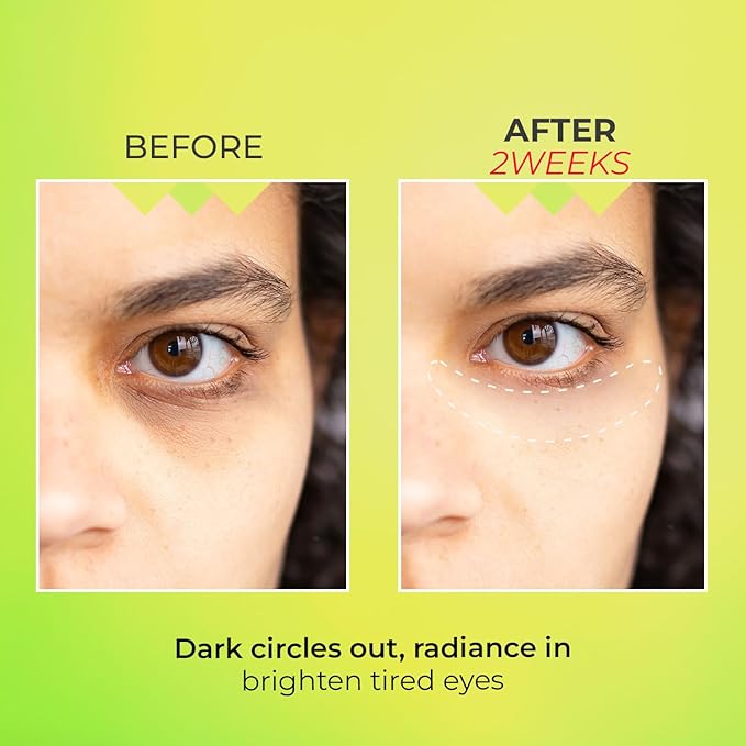 Look at Me Teen Again Dark Circle Eye Cream, Anti-Aging Line Smoothing Skin Care Treatment, Wrinkle Care, Cruelty Free, for Women and Men 0.84 fl. oz 25 ml