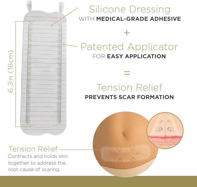 Embrace Scar Treatment, Silicone Sheets for New Scars with Active Scar Defense, Extra Large 6.3 Inch Sheets, 60 Day Supply (Recommended Treatment)
