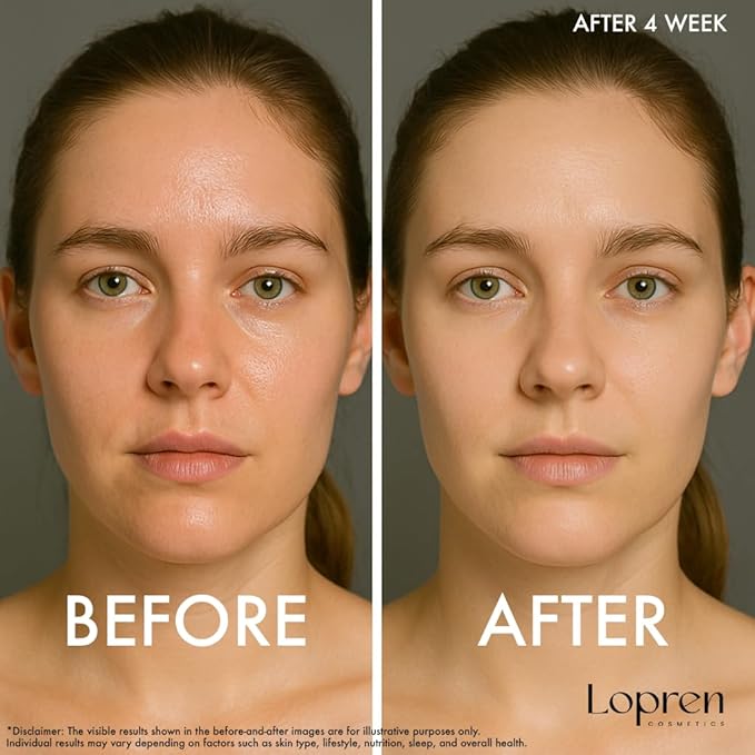 Niacinamide & Hyaluronic Acid Serum – Oil Control, Pore Minimizer, Acne & Blemish Treatment, Hydrating Face Serum for Balanced & Radiant Skin, 1 Fl Oz