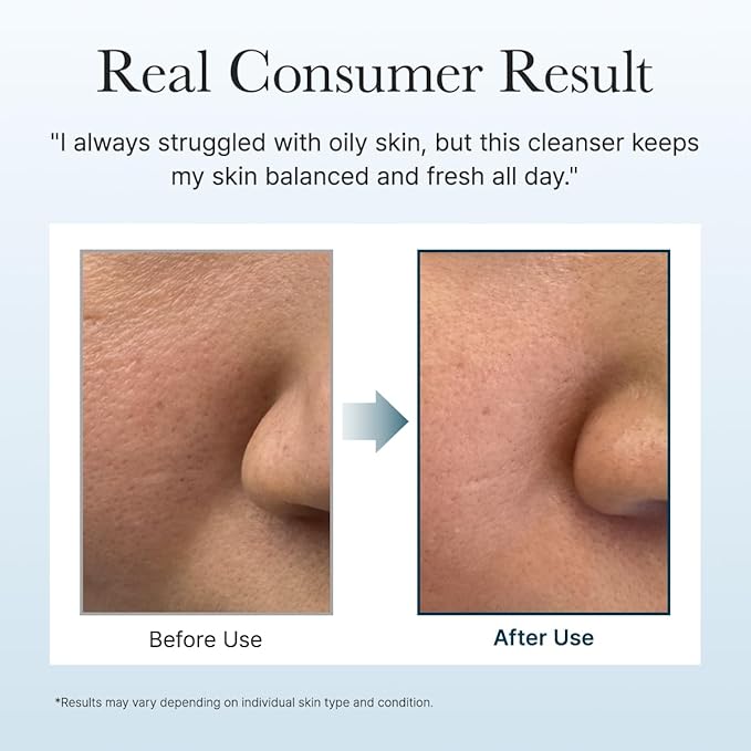 Hyssop Brightening & Deep-Cleansing Face Scrub & Exfoliator - for All Skin Types, Acne-Prone Skin & Blackheads (4.23oz)