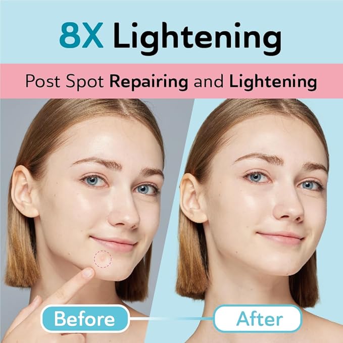 Dark Spot Patches Blemish Patches with Hydrocolloid, TXA & CICA for Active Acne & Post-Inflammatory Dark Spots - Day and Night Use - UPGRADED (Post Acne - 132 Count - 2 Size)