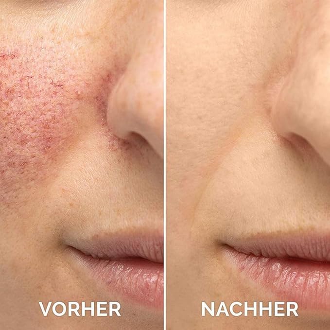 Vitamin C Serum For Face, Anti Aging Face Serum with Vitamin C, Hyaluronic Acid, Vitamin E – Brightening Formula – Improve Appearance of Dark Spots, Tone, Fine Lines & Wrinkles (2Pcs)