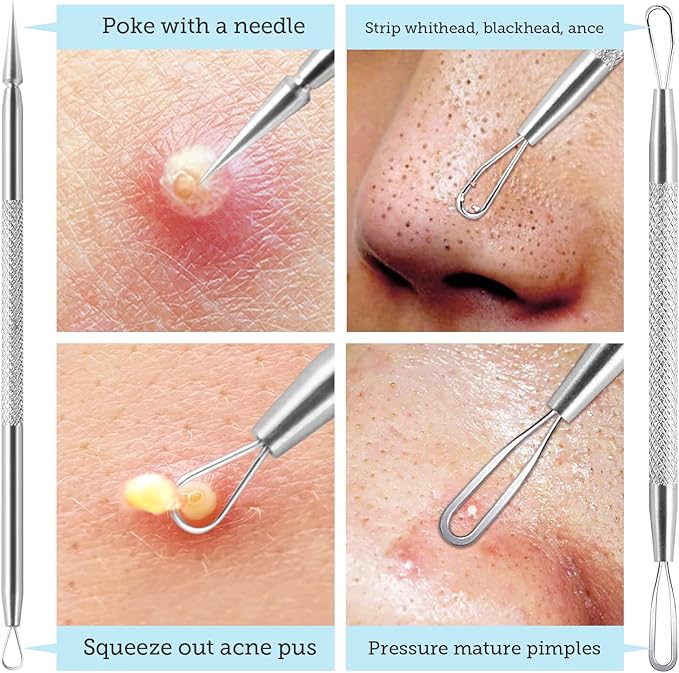 LitBear Pore Prep Tool, Blackhead Remover Pimple Popper Tool Kit, Stainless Steel Blackhead Extractions Tool for Acne, Whitehead Popping, Blemish, Comedone, Black