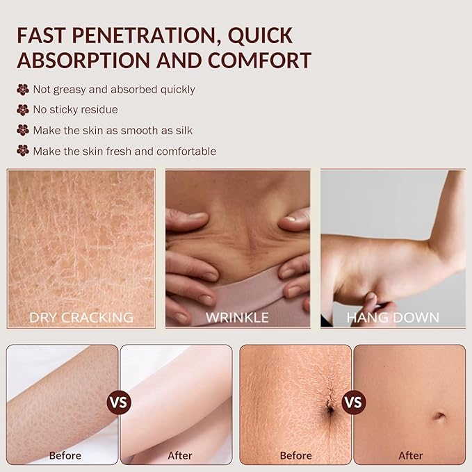 Body Firming Oil Glow-Remedy body oil for women,Body Oil After Shower Tightening&Hydrating Treatment for Arms,Legs,Stomach&Body,Natural Firming Oil for Dry Skin,Non-Greasy Body Serum-(4.06 Fl. Oz)