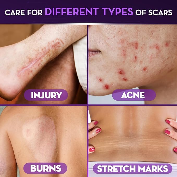 Cicatricure Advanced Scar Gel for Face & Body - Proven Results in 2 Weeks, Scar Treatment for Surgical Scars, Stretch Marks, Scars of Burns and Injuries, Acne Scar Treatment, 1 oz (28 g) - Pack of 3