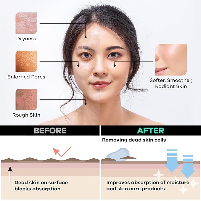 Dermasuri Deep Exfoliating Face Mitt - Scrubber, Dead and Dry Skin Remover for Men and Women - Exfoliator Gloves for Shower and Dry Use - (2 Pack)