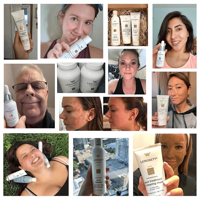 LEROSETT Facial Clay Mask for Acne, Oily Skin, Visibly Tightens Pores. Overnight Spot Treatment for Pimples, Blemishes, Cysts, Blackheads. 100% Natural, Spa-Grade, Made in Sweden Since 1987