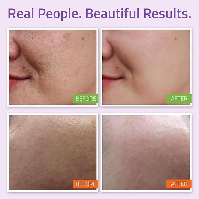 YEOUTH Skin Care Set: Hyaluronic Acid Serum, Vitamin C Serum, Face Cleanser, Toner, Under Eye Gel, Face Cream, 6-Piece Skincare Kit For Women & Men