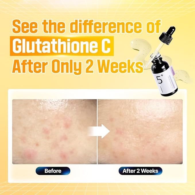 numbuzin No.5 Serum DUO | Tranexamic Acid 4%, Niacinamide 5%, Glutathione, Vitamin C | Vitamin Concentrated Serum | Hyperpigmentation| Suitable for Sensitive Skin | 2.02 fl. oz.