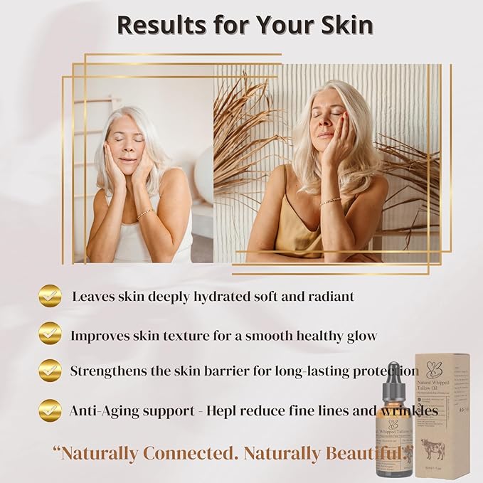 Niacinamide Serum for Face - Beef Tallow Face Serum B3 – Natural Moisturizer for Dry & Sensitive Skin – Anti-Aging, Hydrating & Repairing – Grass-Fed Tallow Skincare