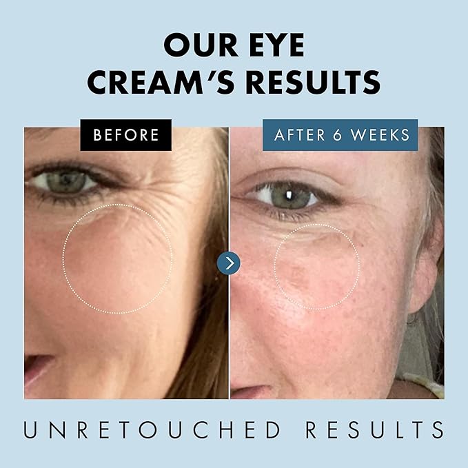 Eclat Skincare Under Eye Cream for Dark Circles & Puffiness – Anti Aging Formula for Wrinkles - Moisturizer for Fine Lines, Crows Feet & Eye Bags – Hydrating Treatment for Firming & Smoothing - 30ml