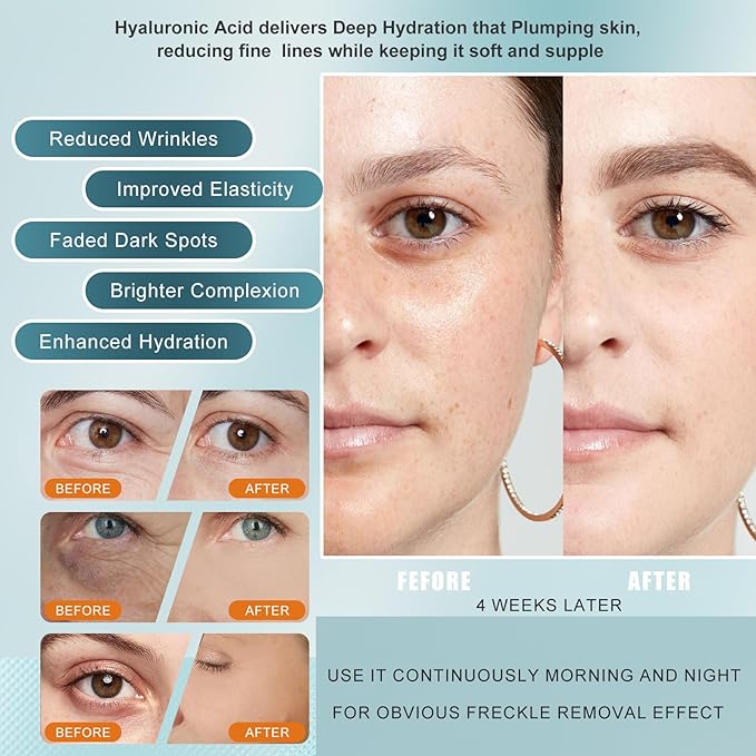 Vitamin C Serum for face with Hyaluronic Acid,Tri-Peptide Anti-Aging Facial Treatment for Mature Skin, Dark Spot Removal, Wrinkle Reduction, Firming, collagen-hydrating,antioxidant formula, 1 fl.oz