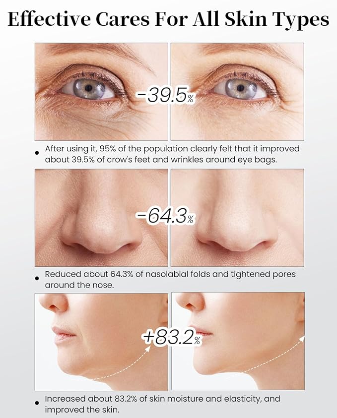 4-in-1 Facial Massager for Face & Neck – Skin Rejuvenation, Lifting & Tightening – Reduces Wrinkles & Puffiness, Enhances Infusion