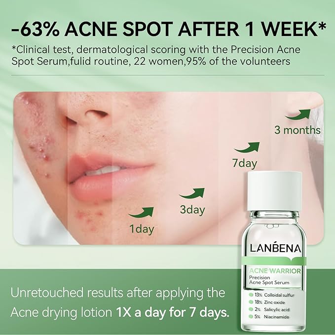 LANBENA Precision Acne Spot Serum, Acne Drying Lotion, Overnight Acne Treatment For Face, Dry Out Pimples, Blemishes, Zits And Clean Pores, 0.42 Fl Oz