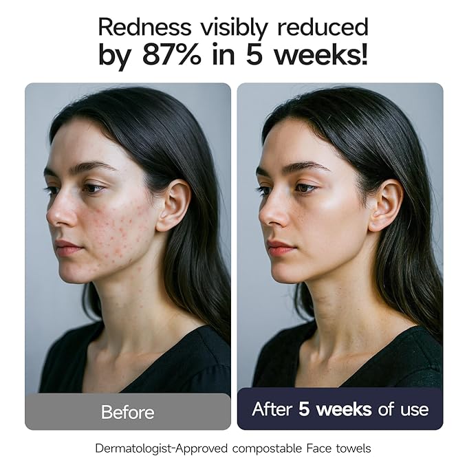 ECOLOOK Disposable Face Towel XL-10"x12" Upgraded Thick Facial Towels, Ultra Soft Clean Face Towels Disposable, 60 Count & 90 GSM, Ideal for Sensitive Skin-3 PACK