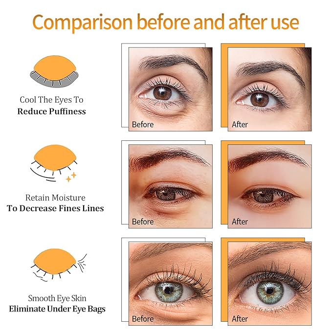 Black Truffle Gold Under Eye Patches - 60pcs Hyaluronic Acid Eye Masks for Moisturizing, Collagen Eye Gel Pads Removing Dark Circles,Wrinkles,Puffiness And Bags