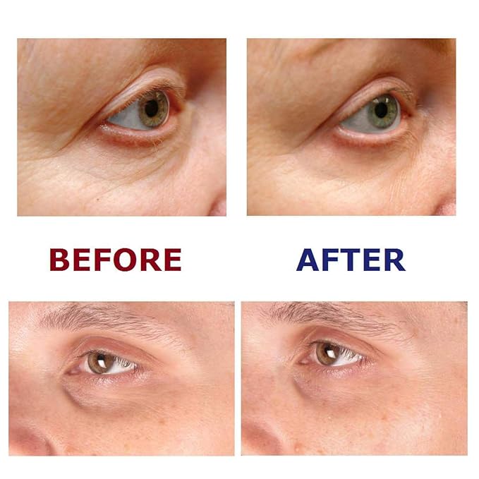 Under Eye Repair Cream - All-Trans-Retinol UNDER EYE REVIVE Anti Aging Eye Cream For Dark Circles And Puffiness, Under Eye Bags, Fine lines, Wrinkles - 0.5 Oz