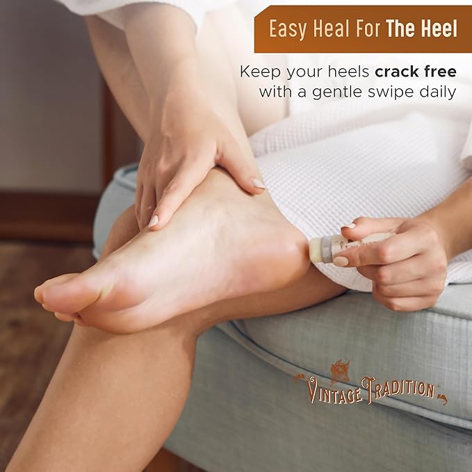 Vintage Tradition Moisturizing Beef Tallow Lip Balm – Tube Lip Moisturizer with Vanilla Extract Hydrates & Soothes Dry Lips – Grass-Fed Tallow Balm for Skin Care, 0.5 Fl. Oz.