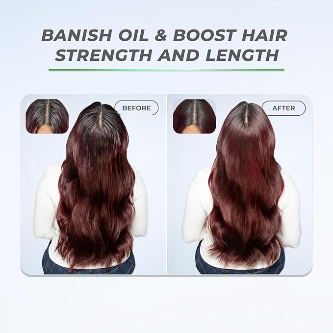 XMONDO Hair BOOST X Dry Shampoo, Zero Residue, Formulated with Saw Palmetto to Promote Scalp Care, Clinically Tested, Dermatologist Tested, Talc-free, Benzene-free, Free of aluminum starch, 5 oz