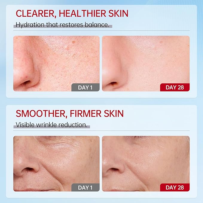 VGO Snail Mucin 92% Moisturizer Daily Face Moisturizer Hydrating Repair Face Gel Cream for Dry & Sensitive Skin, All Skin Types 50g / 1.76oz