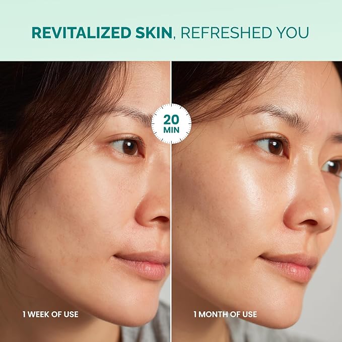 PLANTIFIQUE Facial Sheet Mask Hydration Heaven 5 pack – Aloe Vera & Hyaluronic Acid Hydrating & Refreshing Face Masks – Korean Skincare for Dry or Tired Skin