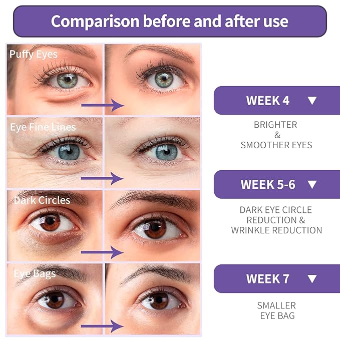 BREYLEE Retinol Eye Cream - Puffy Eyes and Dark Circles Treatments – Look Younger and Reduce Wrinkles and Fine Lines Undereye, Improve and Firm eye Skin - Pure Natural Material Extraction