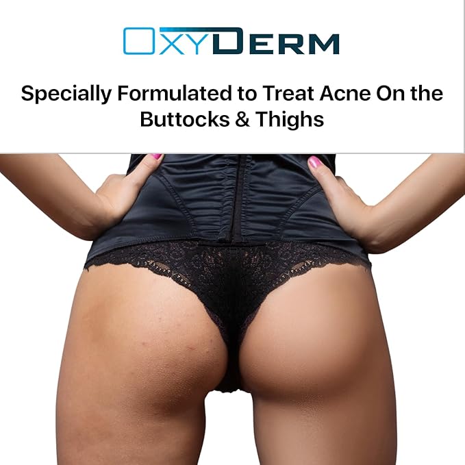 Butt & thigh Acne Treatment Pads - Exfoliating Pads to Eliminate Acne Causing Bacteria. Removes Pimples, Blemishes & Ingrown Hairs for the Buttocks & Thigh Area for Both Men & Women.