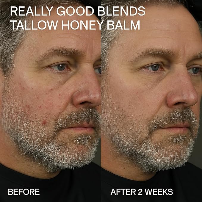 Tallow and Honey Balm, Organic Body Butter, Grass-Fed Beef Tallow for Skin, Soothing All-Natural Moisturizer for Body and Face | Made in USA - 2 oz (Vanilla Orange)