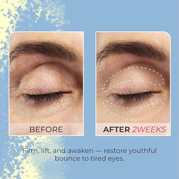 Look At Me Teen Again Roll-On Firming Eye Cream, Anti-Aging Line Smoothing Skin Care Treatment, Wrinkle Care, Cruelty Free, for Women and Men 0.54 fl. oz, 16ml