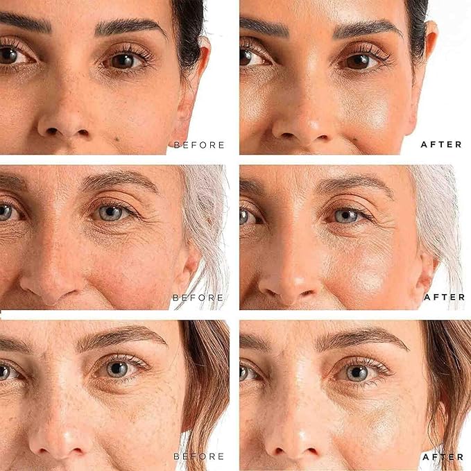 Age Barrier Advanced Cream - Fix & Renewal Facial Cream - Hydrating Face Moisturizer, Anti Aging & Skin Barrier Repair Face Cream