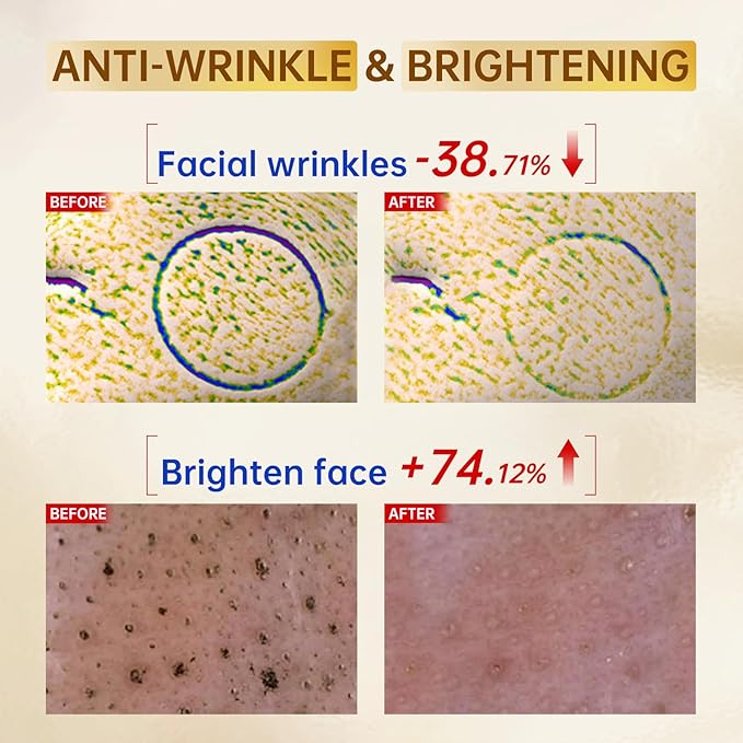 Vitamin C Face Serum with Vitamin C, Hyaluronic Acid, Vitamin E, Serum for Dullness, Balanced Complexion, Eye Area, Fine Lines & Wrinkles, 60ml/2.02oz