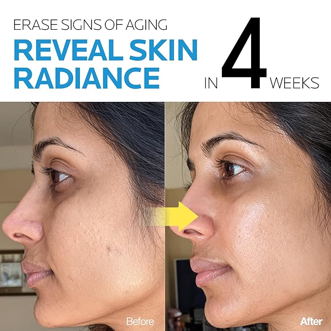 mimmua Dark Spot Ampoule | Korean Clinic Skincare - NAD+ 0.1% & Thioctic Acid 0.01% & Niacinamide 10% | Overnight Treatment for Melasma, Hyperpigmentation, Discoloration, Acne Scars | 15ml /0.33 Fl Oz