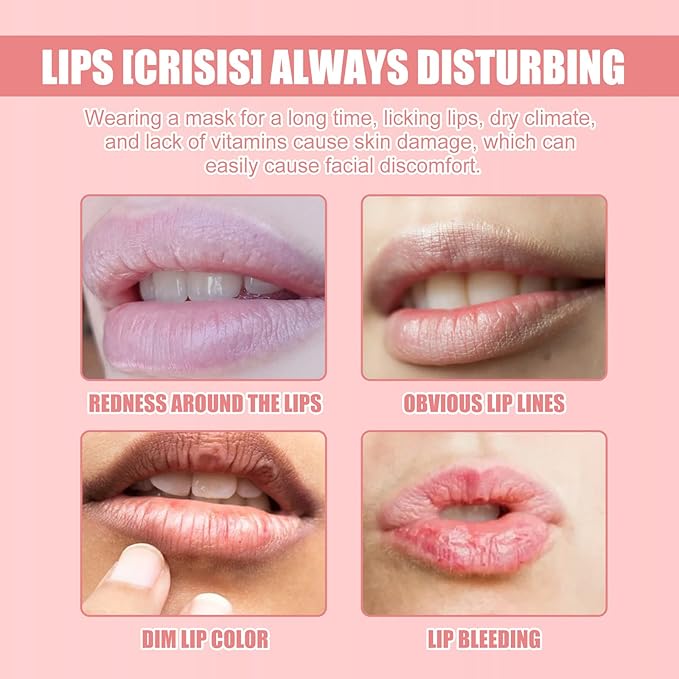Honey Lip Balm Pot, Propolis Lip Mask, Strawberry Hydrating Propolis Lip Sleeping Mask, Prevent Dry&Cracked, Lip Repair Nourishes the Lip Skin (Strawberry)