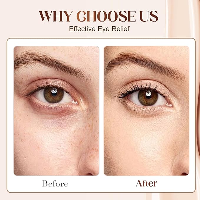 Lutein Eye Essence Oil, 2025 NEW VC Lutein Anti-Wrinkle Eye Serum Oil, Hydrating Dark Circles Remover for Daily Eyes Care, Lightweight Tightening Eyes Oils for Women (1pc, Scented)