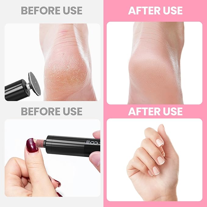 Electric Callus Remover for Feet, Rechargeable Professional Electronic Foot File Nail Grinder,9 Adjustable Speed Foot Sander Scrubber Pedicure Tool for Dry Dead Skin with Sandpaper Discs (Black)