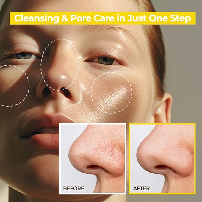 AVCA Blackhead Remover Cleansing Oil 10.14 fl.oz.(300ml) - Makeup & Blackhead Remover, PHA Gentle Exfoliator, Lightweight Pore Cleanser, Korean Skincare for Normal & Oily Skin