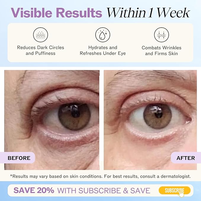 LilyAna Naturals Eye Cream for Dark Circles and Puffiness, Anti Aging Under Eye Cream for Wrinkles and Bags helps Improve Dryness; for Sensitive Skin (Bottle, 1.0 Ounce (Pack of 1))