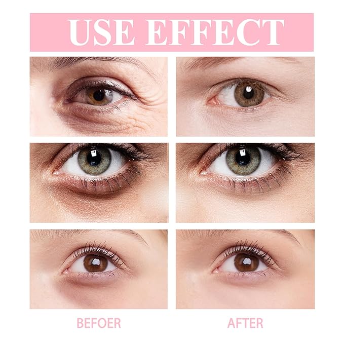 Retinol Eye Stick with Vitamin C Eye Cream for Dark Circle and Puffiness, Brightening Eye Balm Reduces Fine Lines and Bags in 4 Weeks