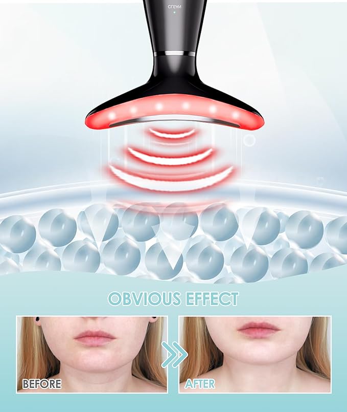 7 Color Neck Face Massager - Facial Massager Tool for Skin Care at Home, Vibrating Face Massager with Thermals, Galvanic Machines Black